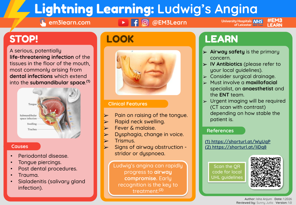 Ludwig's Angina