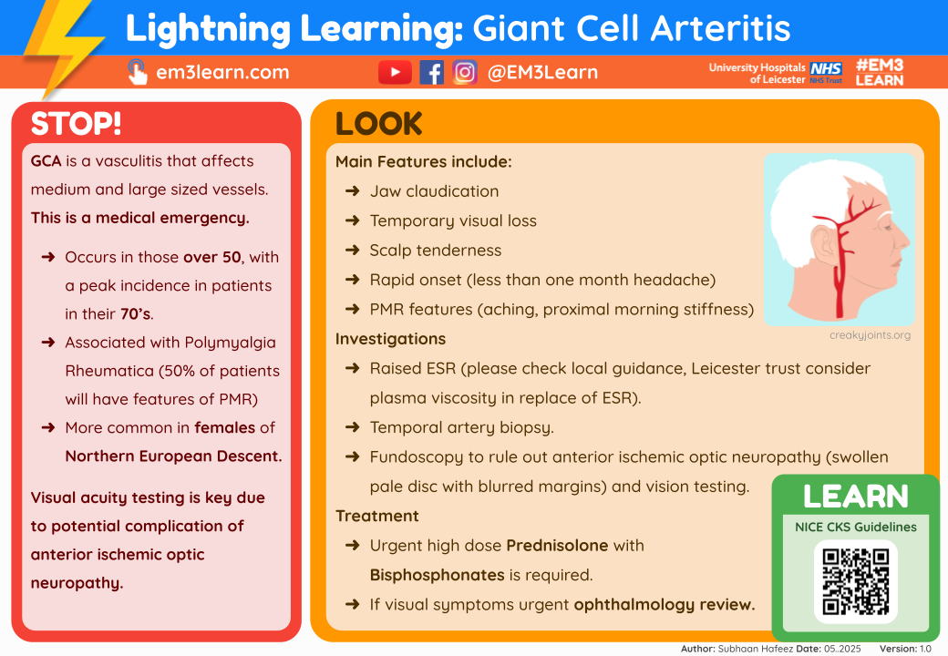 Giant Cell Arteritis