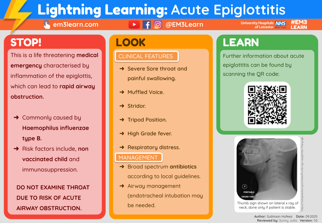 Acute Epiglottitis