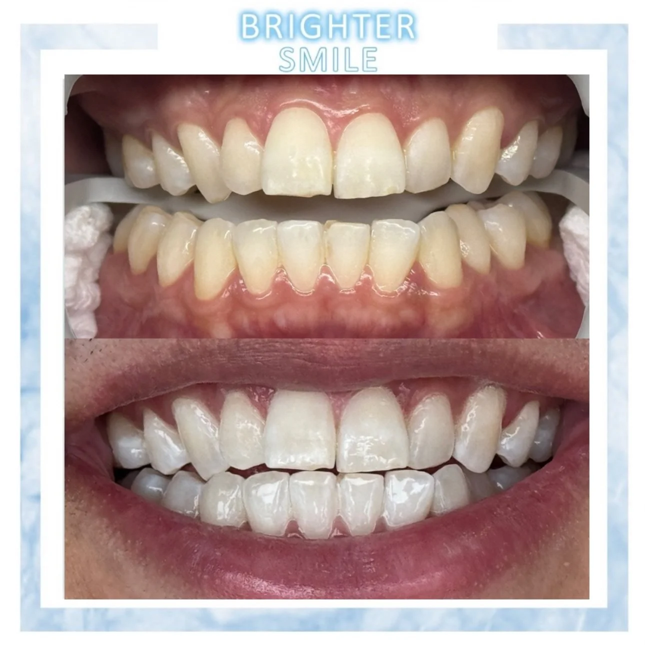 From S22 to S14 ✨ this is not his whitest potential! Stay tuned for second treatment 😉