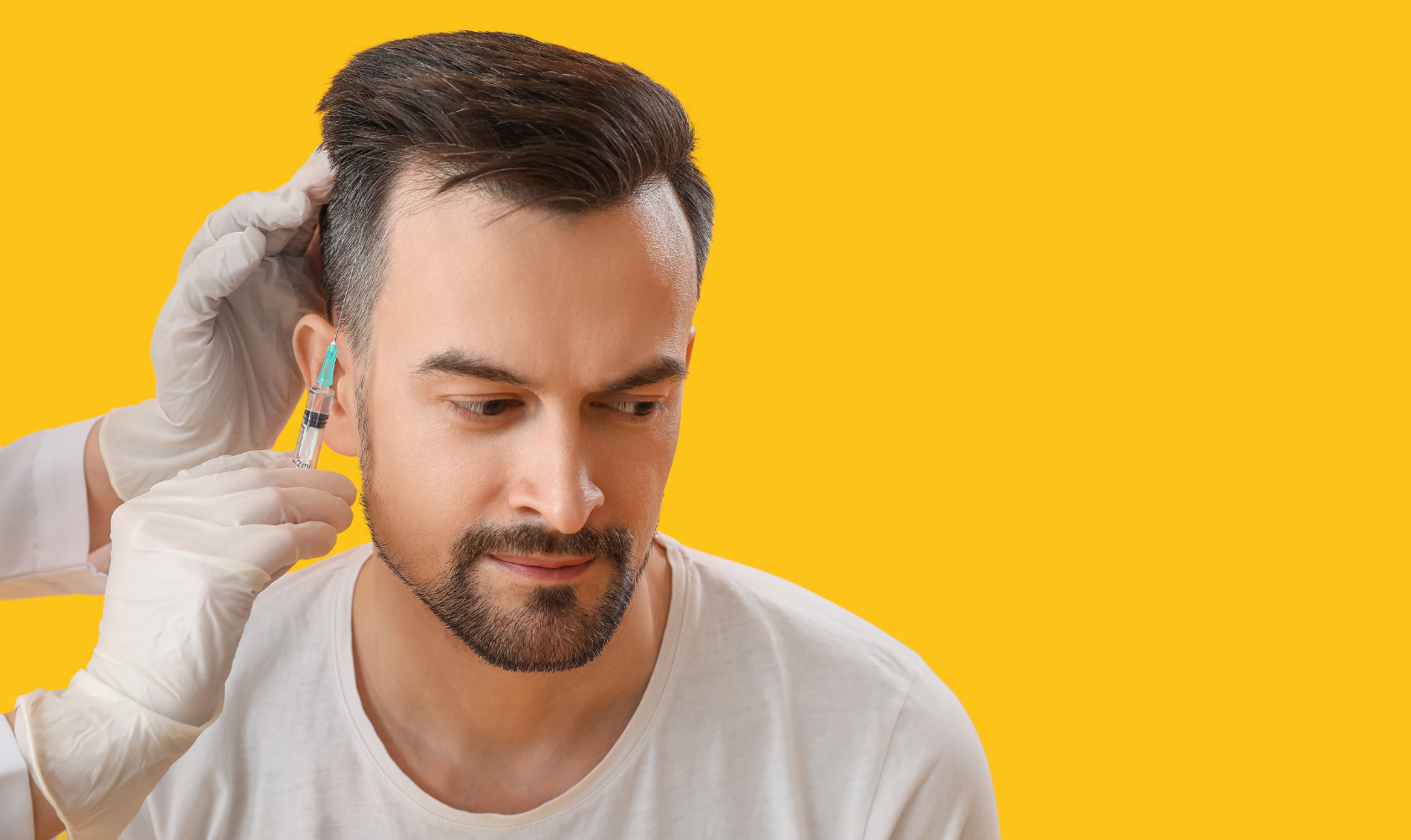 PRP Hair Restoration