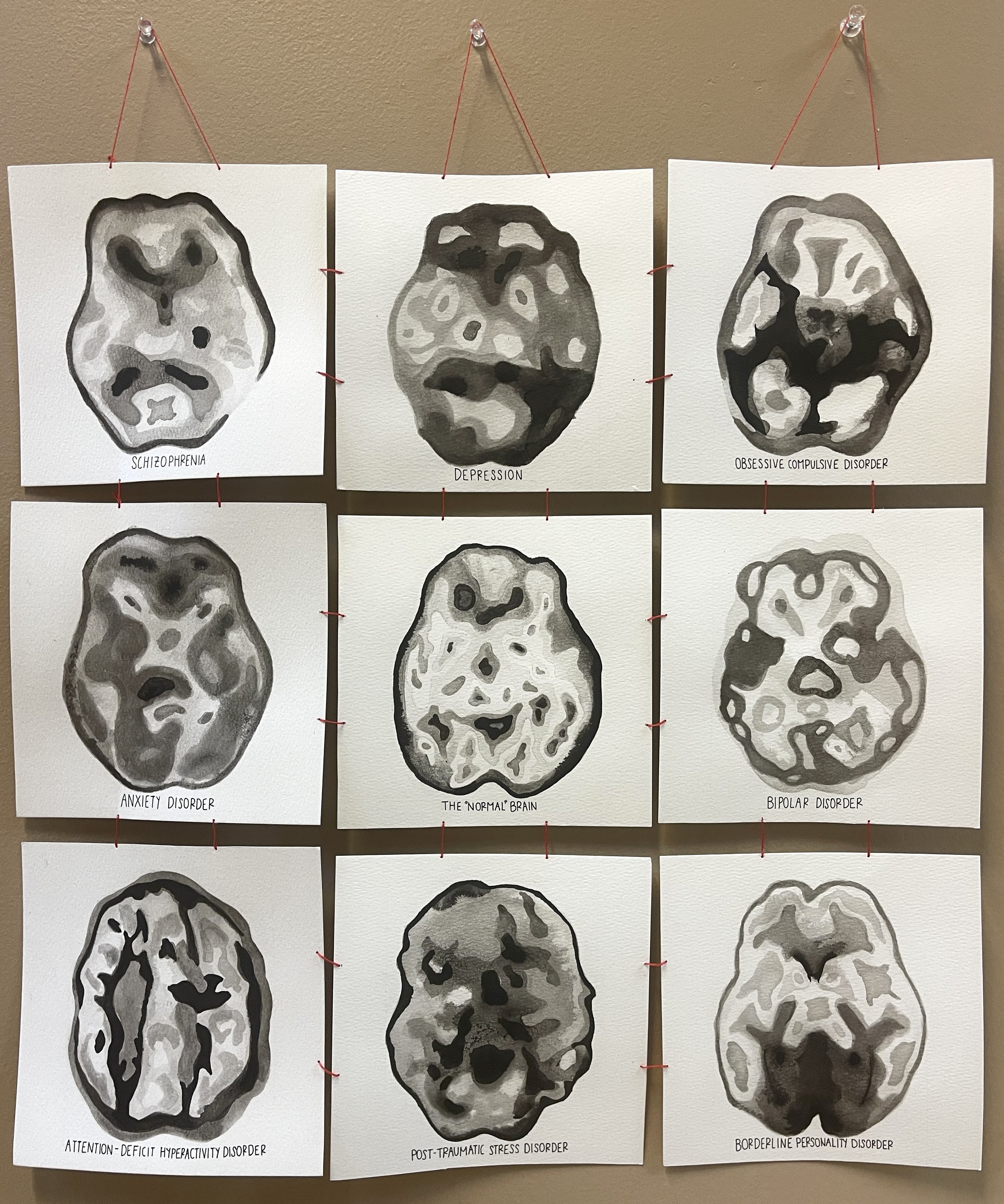 Brain Scans.jpg