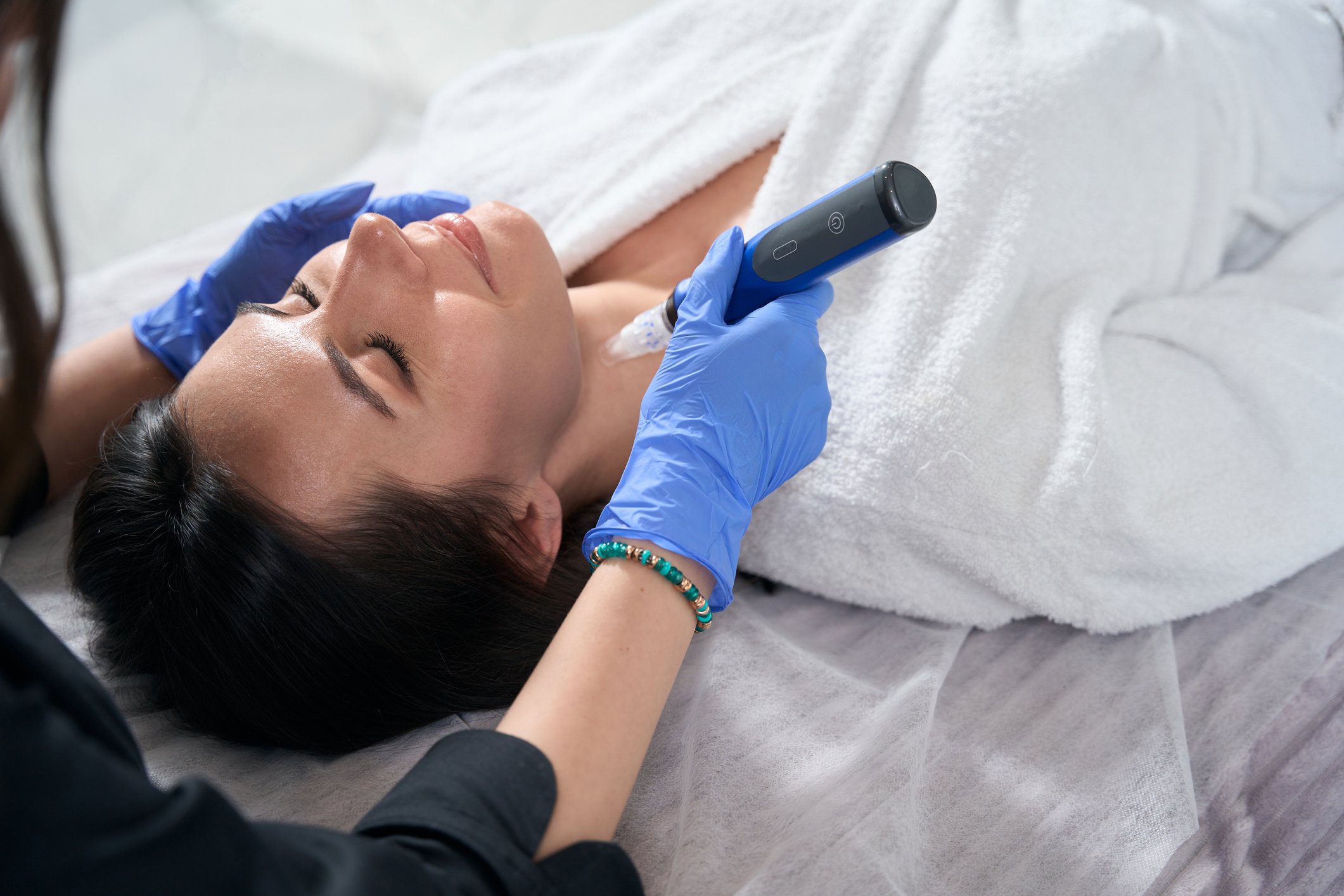 Microneedling treatment for the face and neck