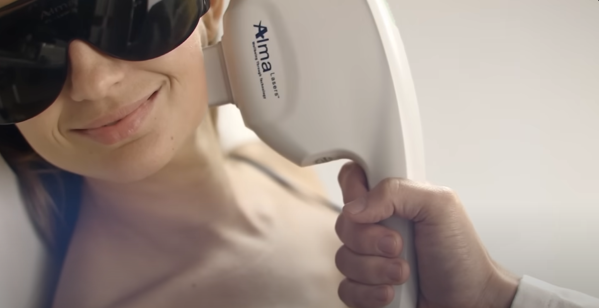 Close-up of a person's face undergoing a pigmentation & age spots laser treatment