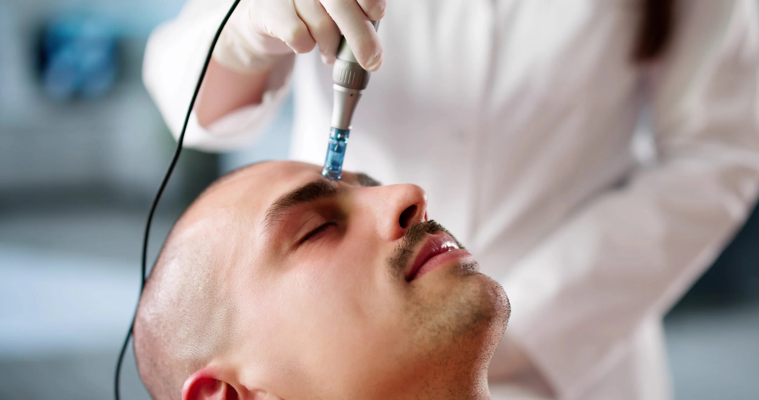 Professional microneedling treatment for texture and collagen renewal.