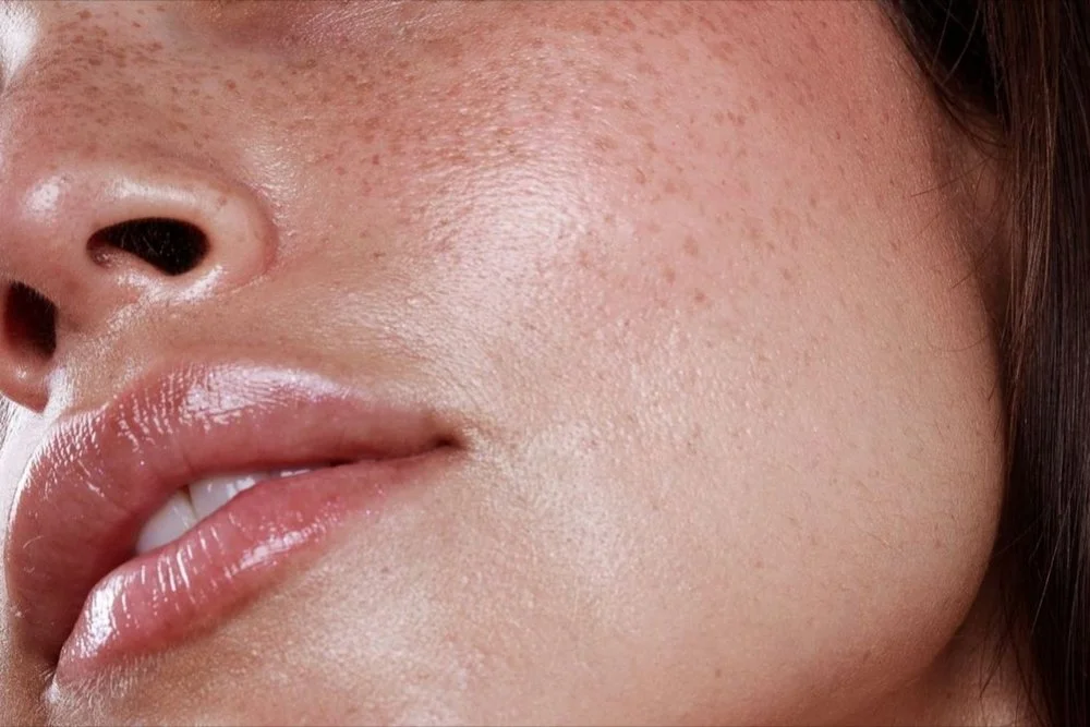 Close‑up of glowing, refined skin after PicoSure Pro laser treatment in Riverside CA.