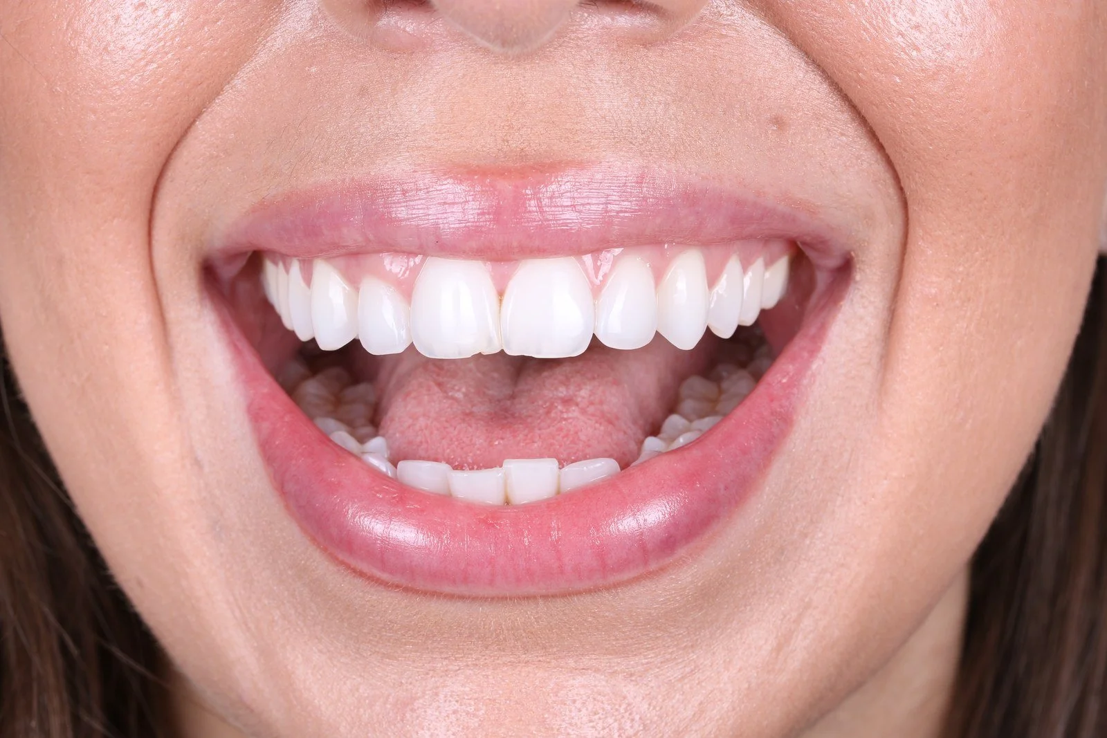 How Much Does Invisalign Cost in Chicago? A Transparent Breakdown for 2026