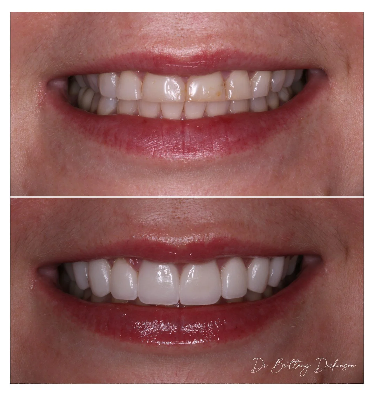 Dr. Brittany Dickinson performs facially driven cosmetic smile design at Chicago Aesthetic Dentistry — Lakeview cosmetic dentist.