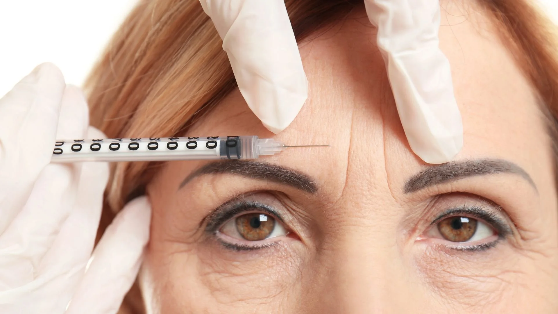 HERO When should I start Botox blog