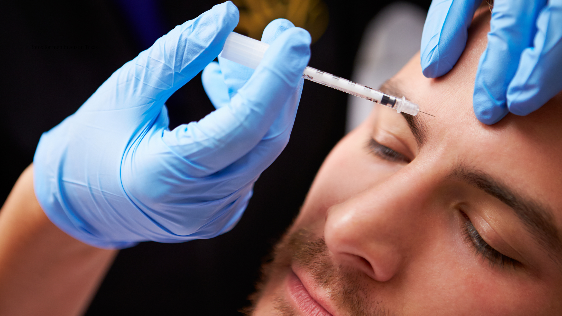 Botox for men in Austin Texas