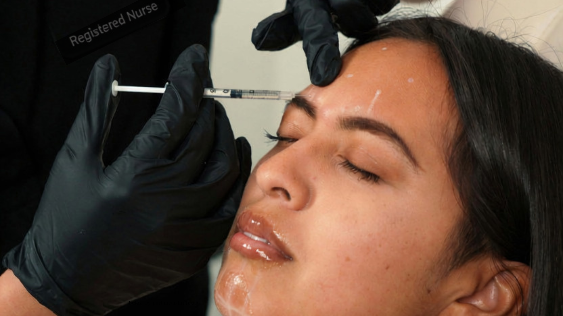 Botox Dysport neurotoxin injection procedure