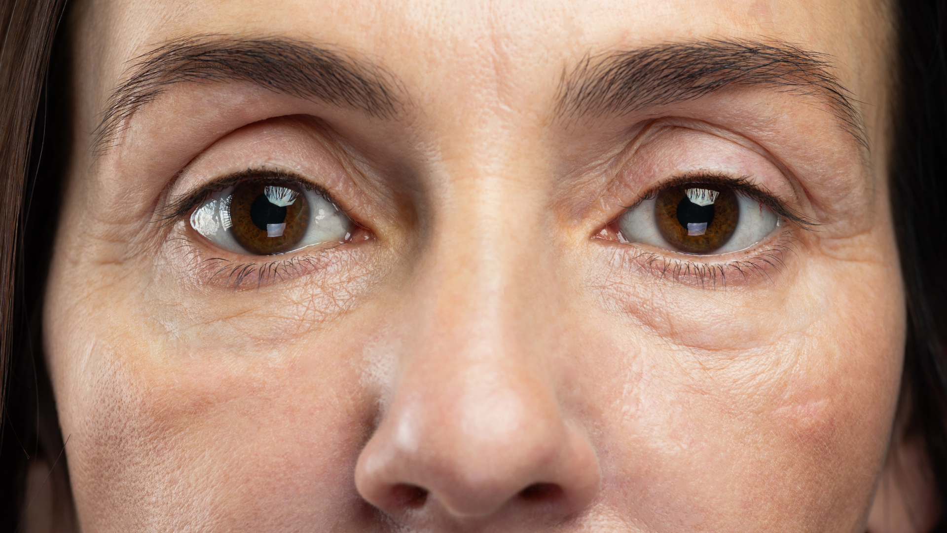Menopause Hormone aging face