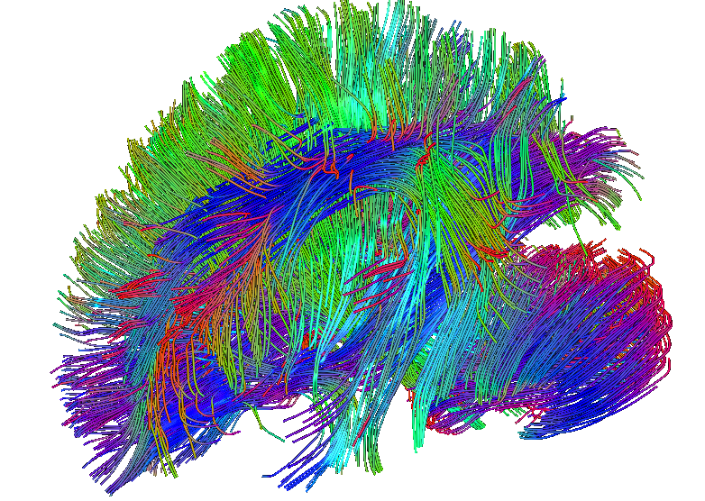 Measuring the Rewiring: Connectivity Biomarkers for the Next Generation of Psychiatric Drugs