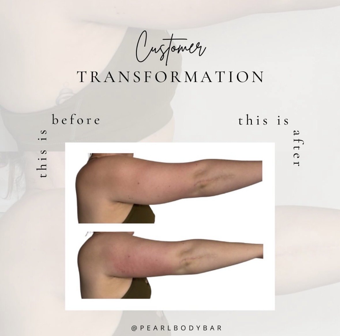 Comparison of a woman's arm before and after a customer transformation, showing the improvement in skin condition.