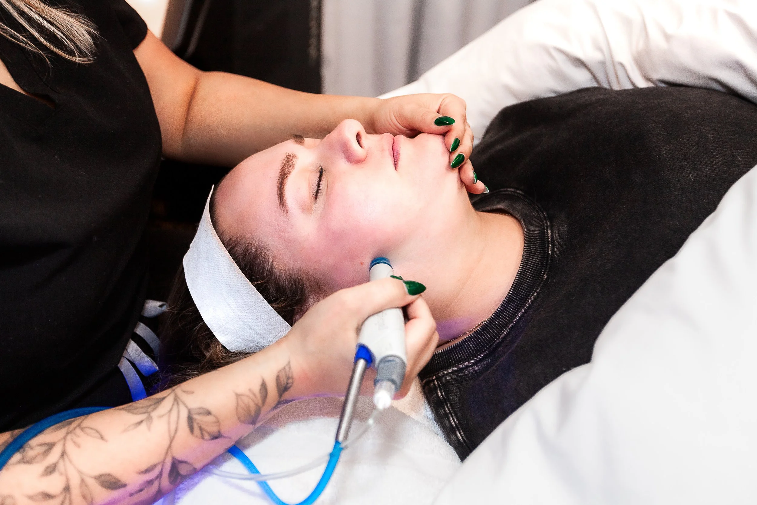 A woman receiving a Hydrafacial treatment in white rock south Surrey area in a medical spa.