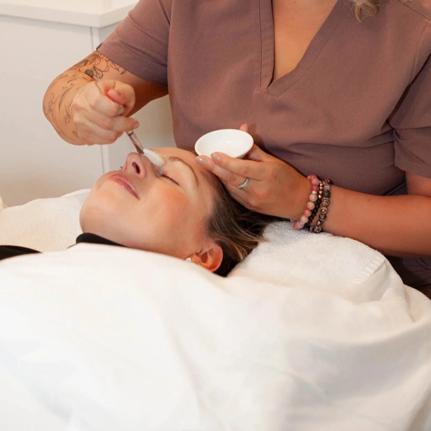 A chemical peel in white rock south Surrey area