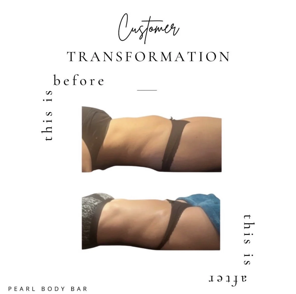 Comparison of a person's back before and after a transformation at Pearl Body Bar. The top image shows the back before, and the bottom image shows the back after.