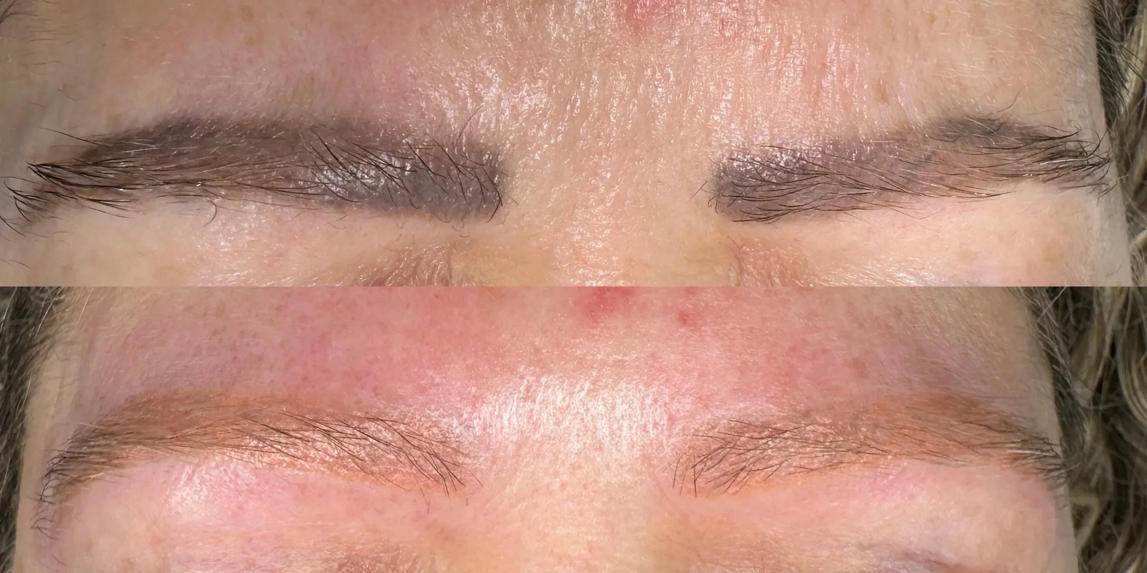 Close-up of a person's eyebrows before and after cosmetic treatment, with the top showing slightly darker, fuller eyebrows and the bottom displaying lighter, more natural eyebrows.