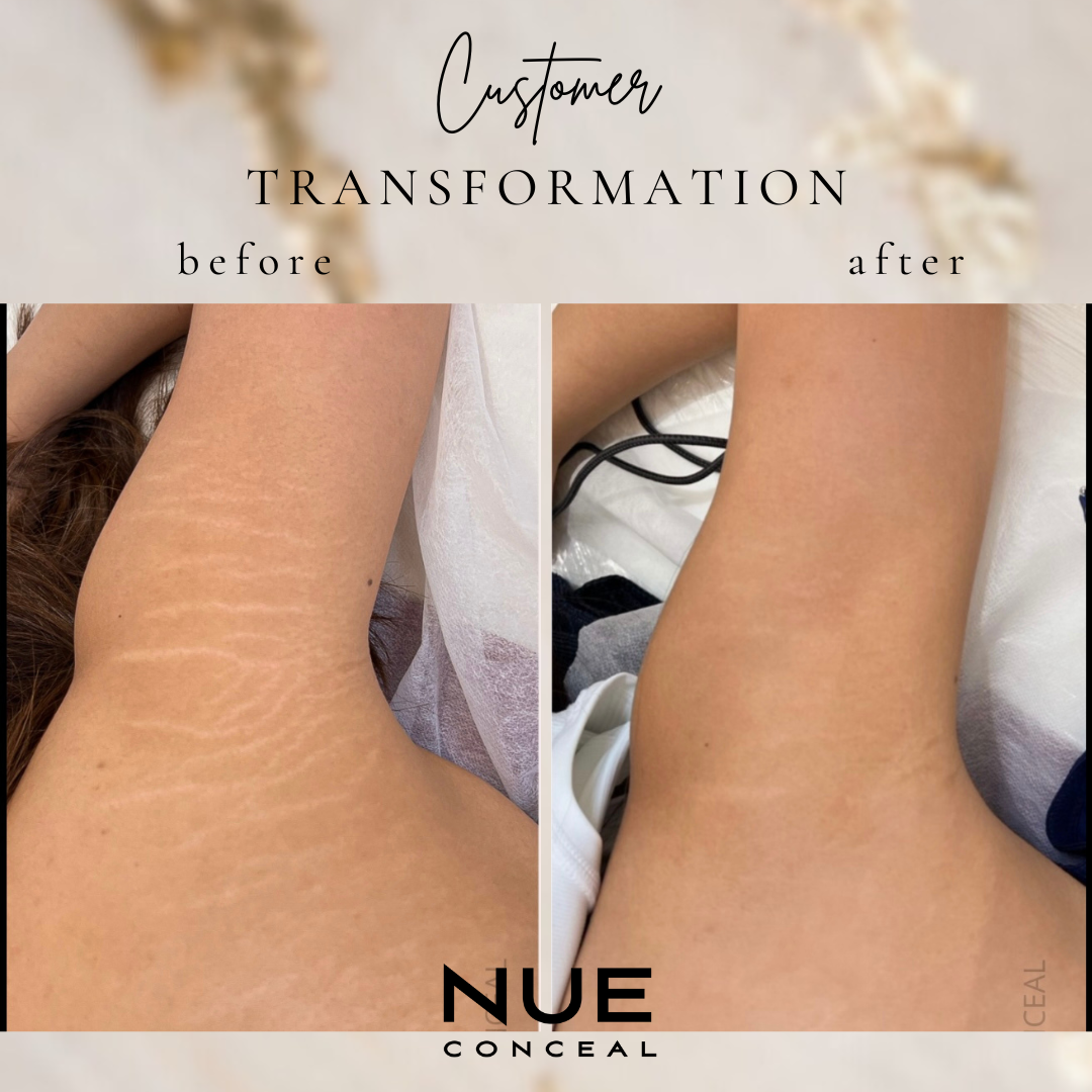 RBS templates for B&As.png.PNG