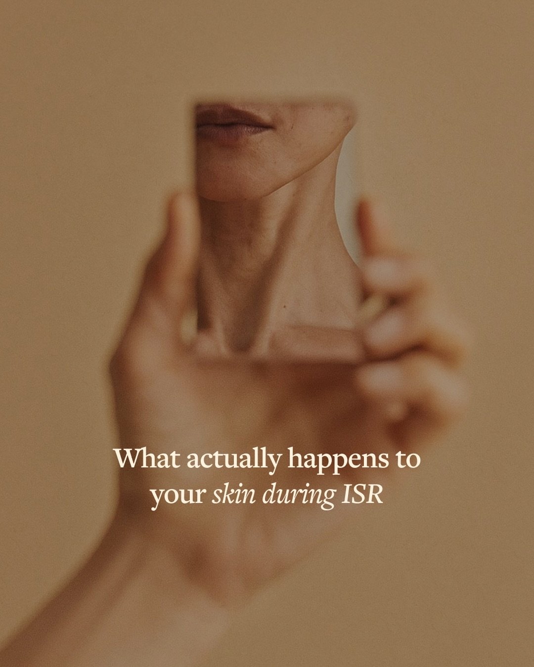 Let&rsquo;s understand what actually happens to your skin during ISR. ✨

ISR works by stimulating your skin&rsquo;s natural healing response, encouraging collagen production and improving overall texture from within.

Over time, this process helps sm