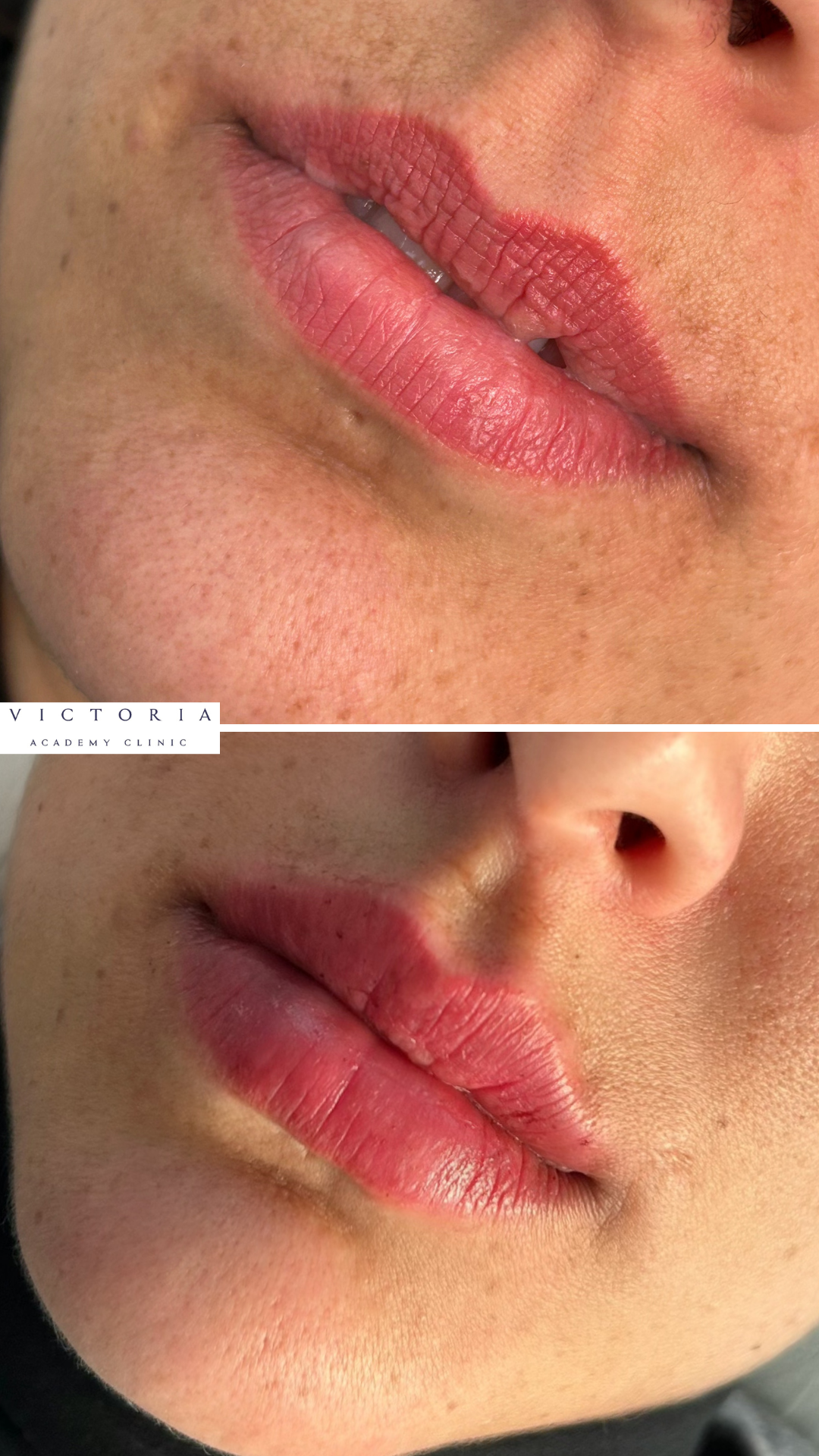 victoria-academy-clinic-filler2.PNG