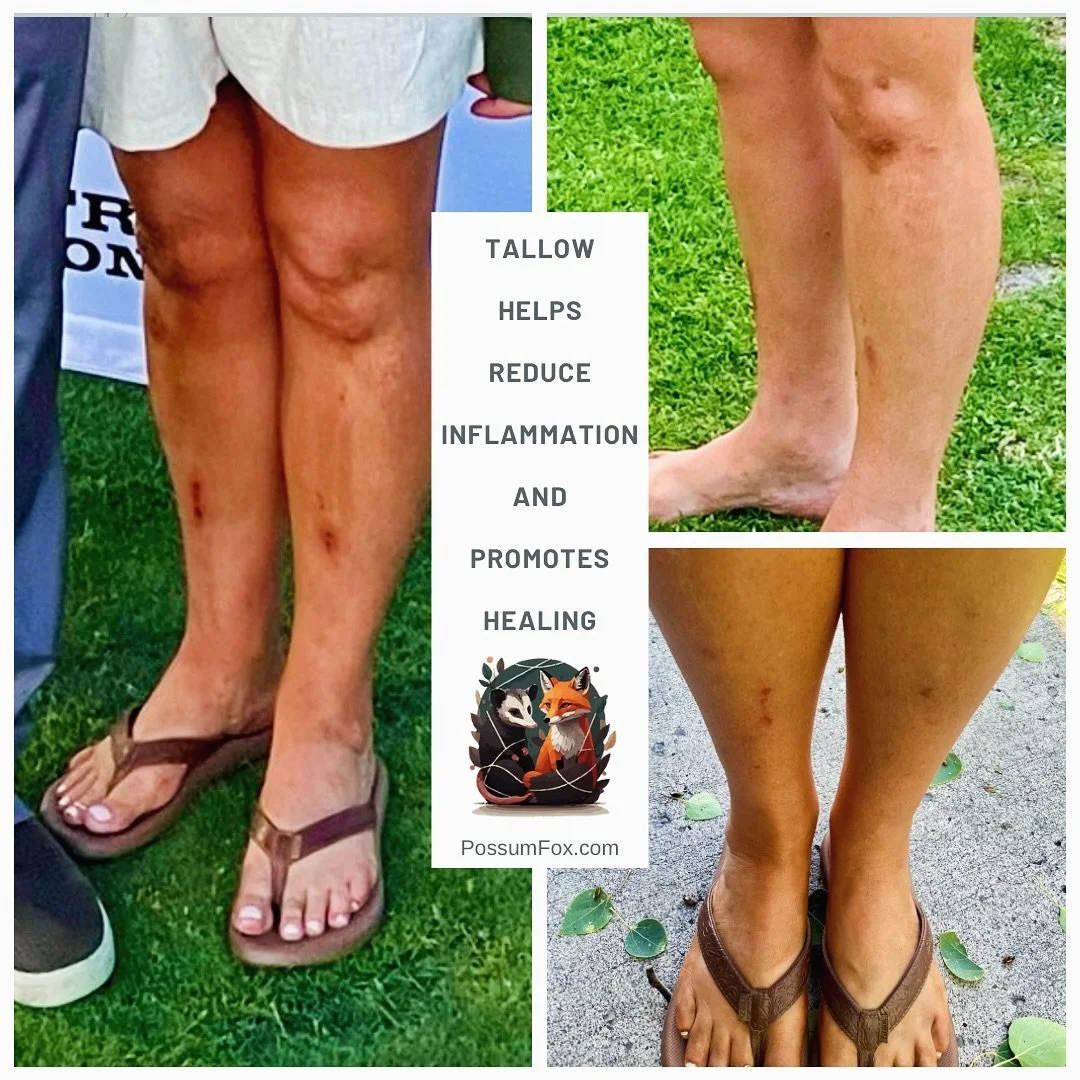 We live for testimonials like this 🙌⁠

A few weeks ago, a dear friend and client came to us with some pretty intense wounds after a bike crash. We suggested she try Snow&mdash;our ultra-simple, 3-ingredient tallow cream made with grass-fed beef tall