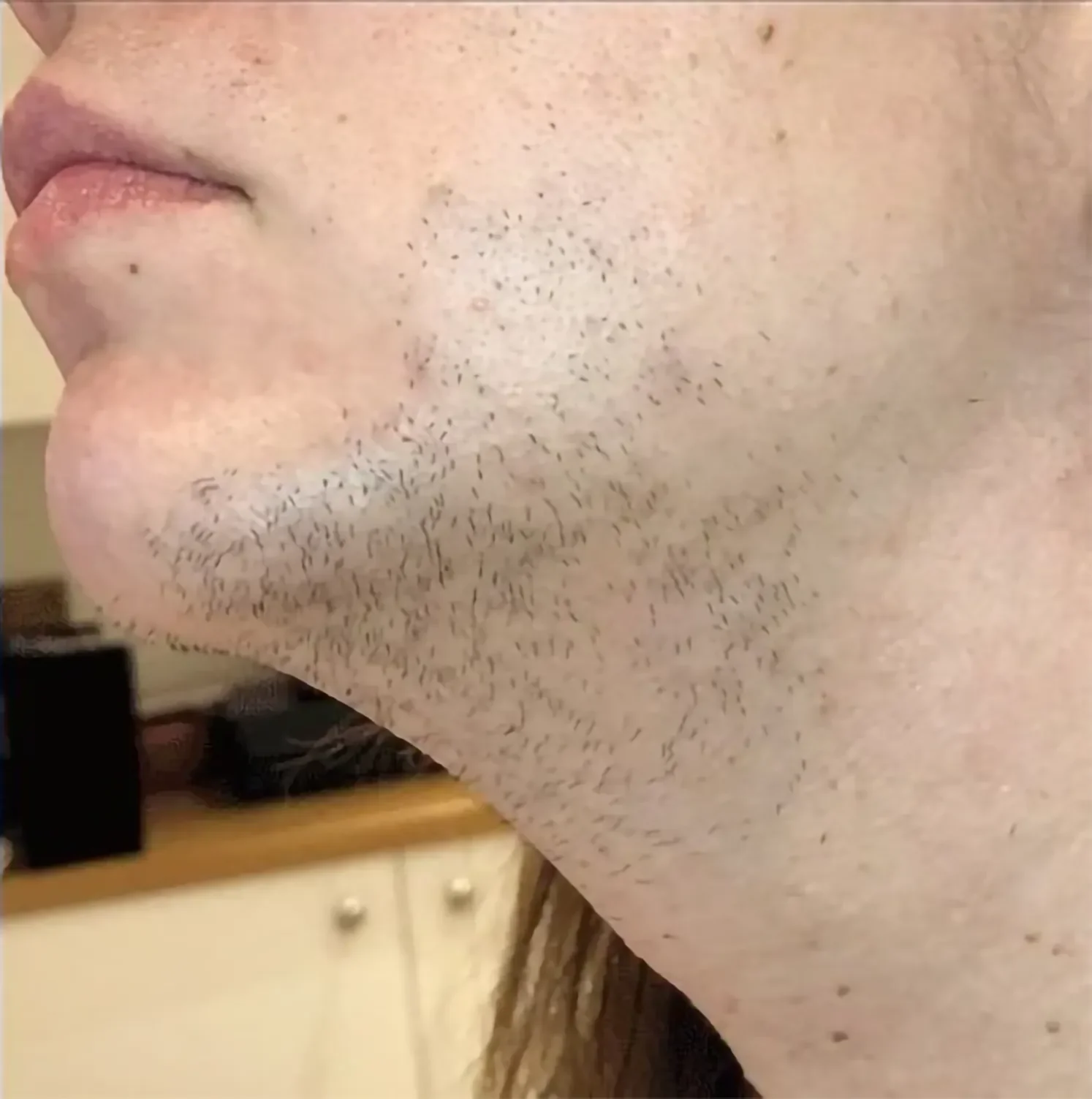 #before