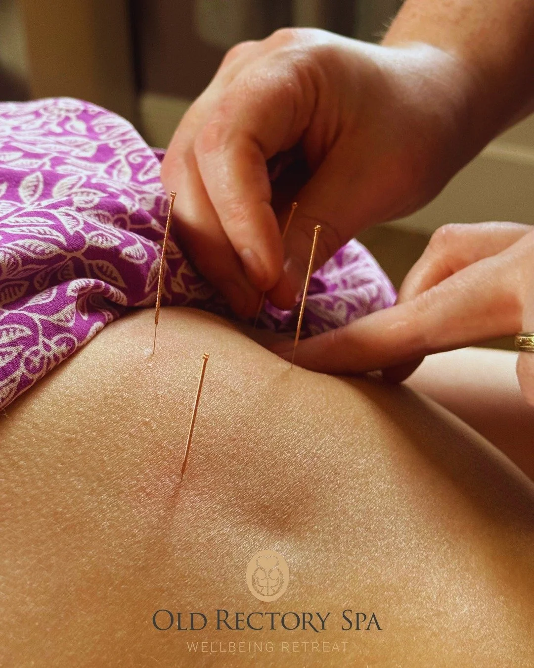 Winter is the season to slow down and protect your energy ❄️✨

Acupuncture can help support circulation, strengthen immunity, and help the body stay resilient through the colder months &mdash; working proactively to prevent illness before it begins.
