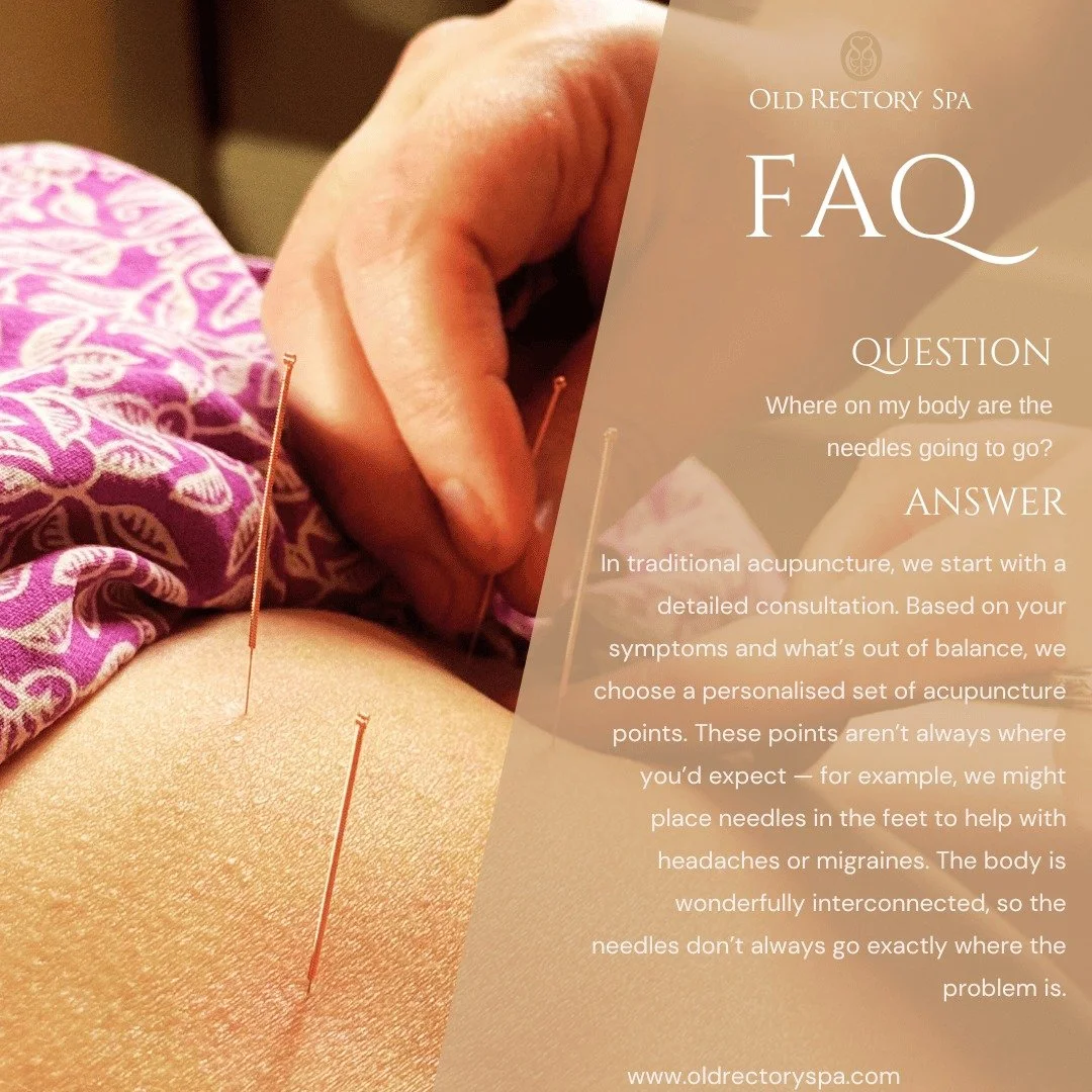 Your acupuncture points are chosen just for you. After a full consultation, we select points based on what your body needs to rebalance. And here&rsquo;s the surprising part - the needles aren&rsquo;t always placed where you feel the issue. Sometimes