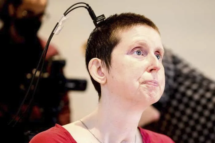 Woman with short brown hair and fair skin undergoing a brain scan using an EEG cap with multiple wires, in a clinical setting.