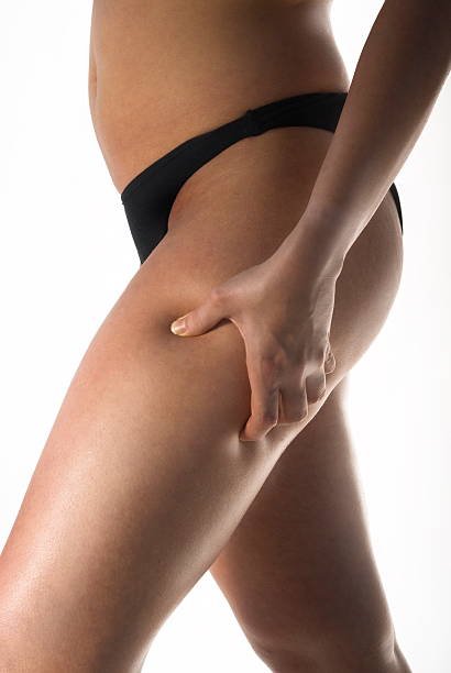 Legs (Two Areas + Cellulite Removal)