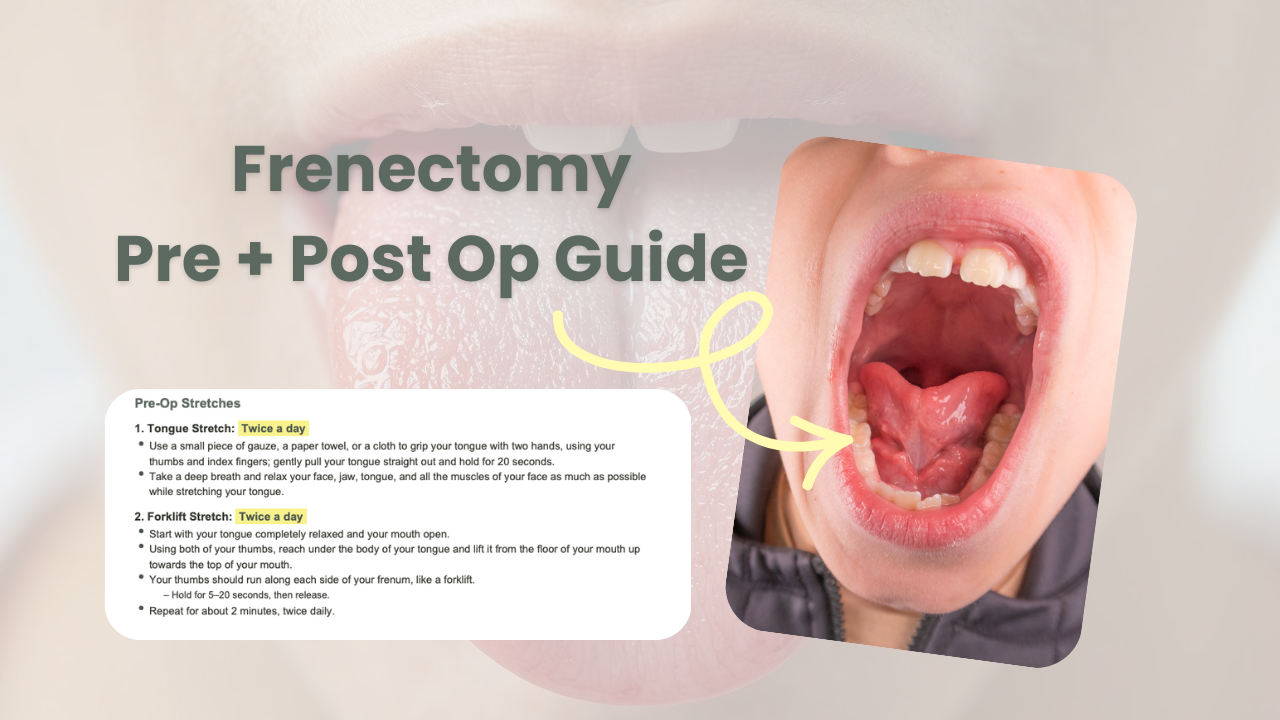 Frenectomy.png