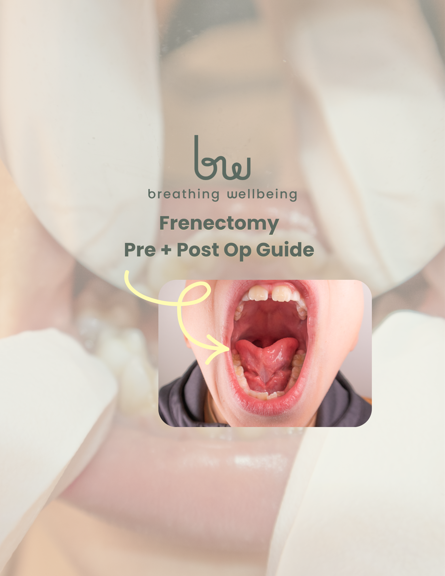Frenectomy Prep + Post Op