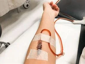 Iron Infusion