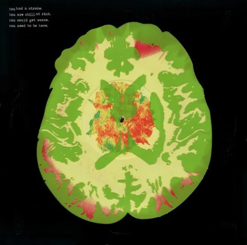 Stroke Manor - The Minus 5 (2019)