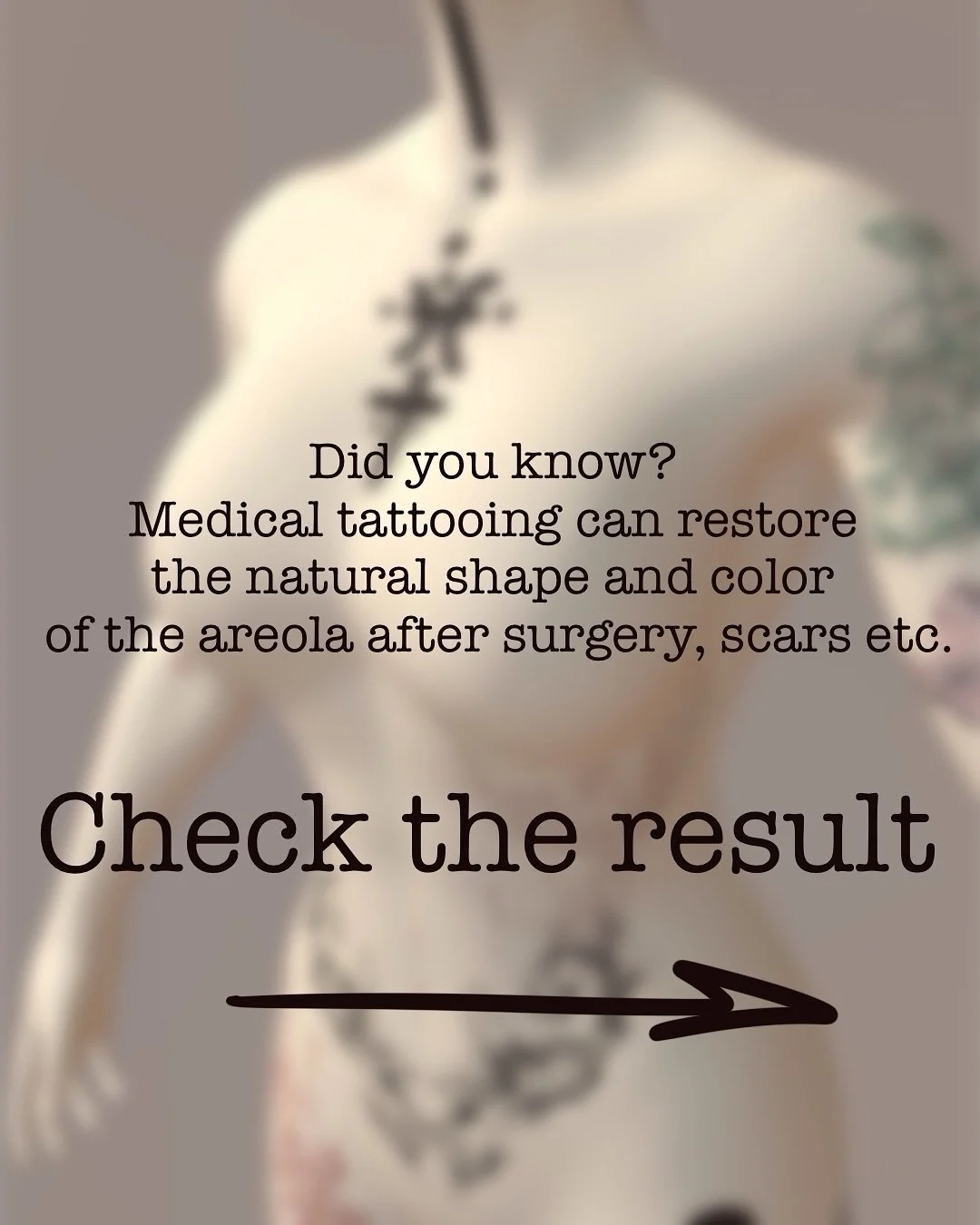 Medical tattooing can restore harmony, natural look, and confidence.
Each result is unique &ndash; tailored to the client&rsquo;s story.
📍 Based in Amsterdam
📩 DM for consultation or booking
.
#areolatattoo
#amsterdamtattoo
#vldrtattoo
#людокол