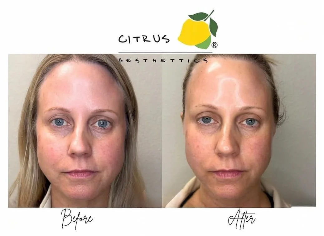 Why Citrus Aesthetics Before and After Photos Look So Natural