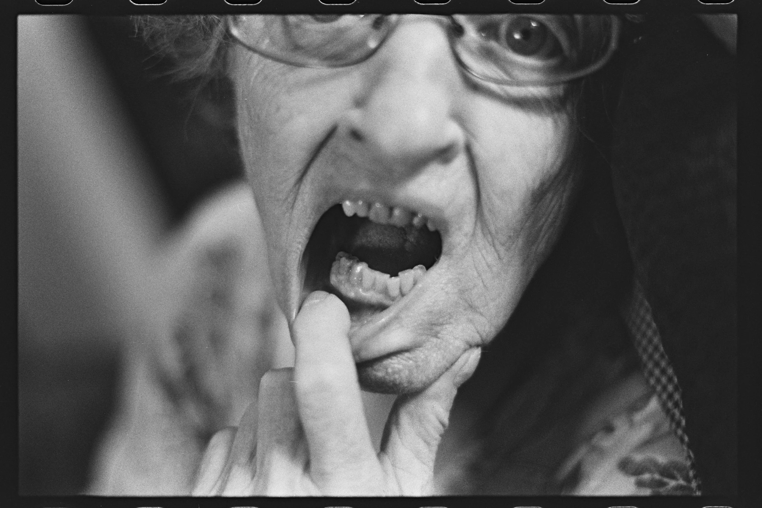 Broken Tooth (16