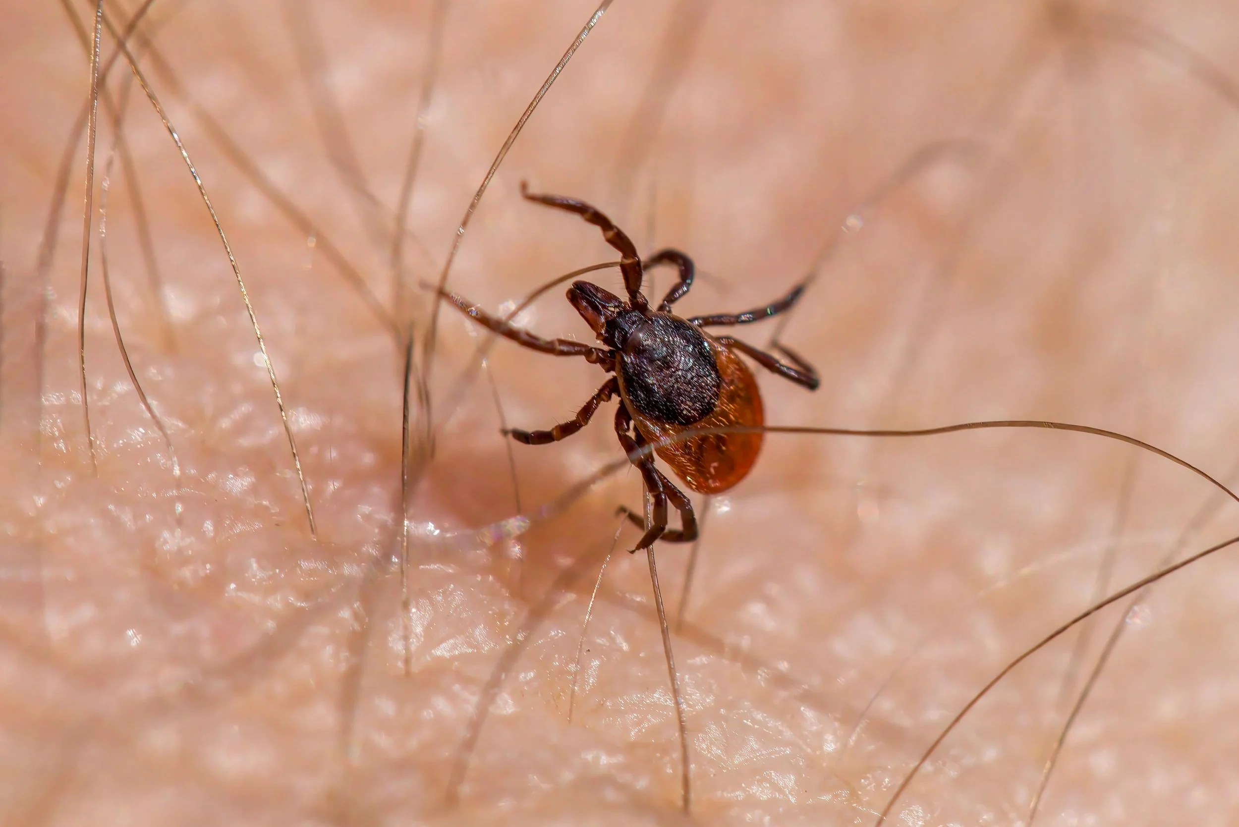 Tick Season in Massachusetts: 
