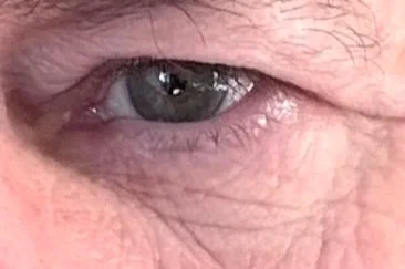 Nahaufnahme eines menschlichen Auges mit sichtbaren Augenlidern und Wimpern.