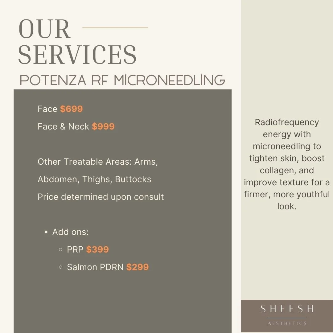 A promotional flyer for Sheesh Aesthetics listing services for Potenza RF Microneedling, including face and face & neck treatments with prices, additional options, and a discount for packages.