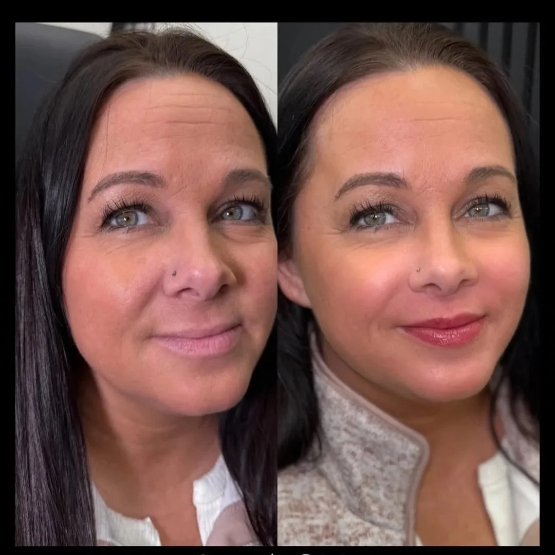 Before and after Lip Blushing tattoo giving soft diffused lip color.