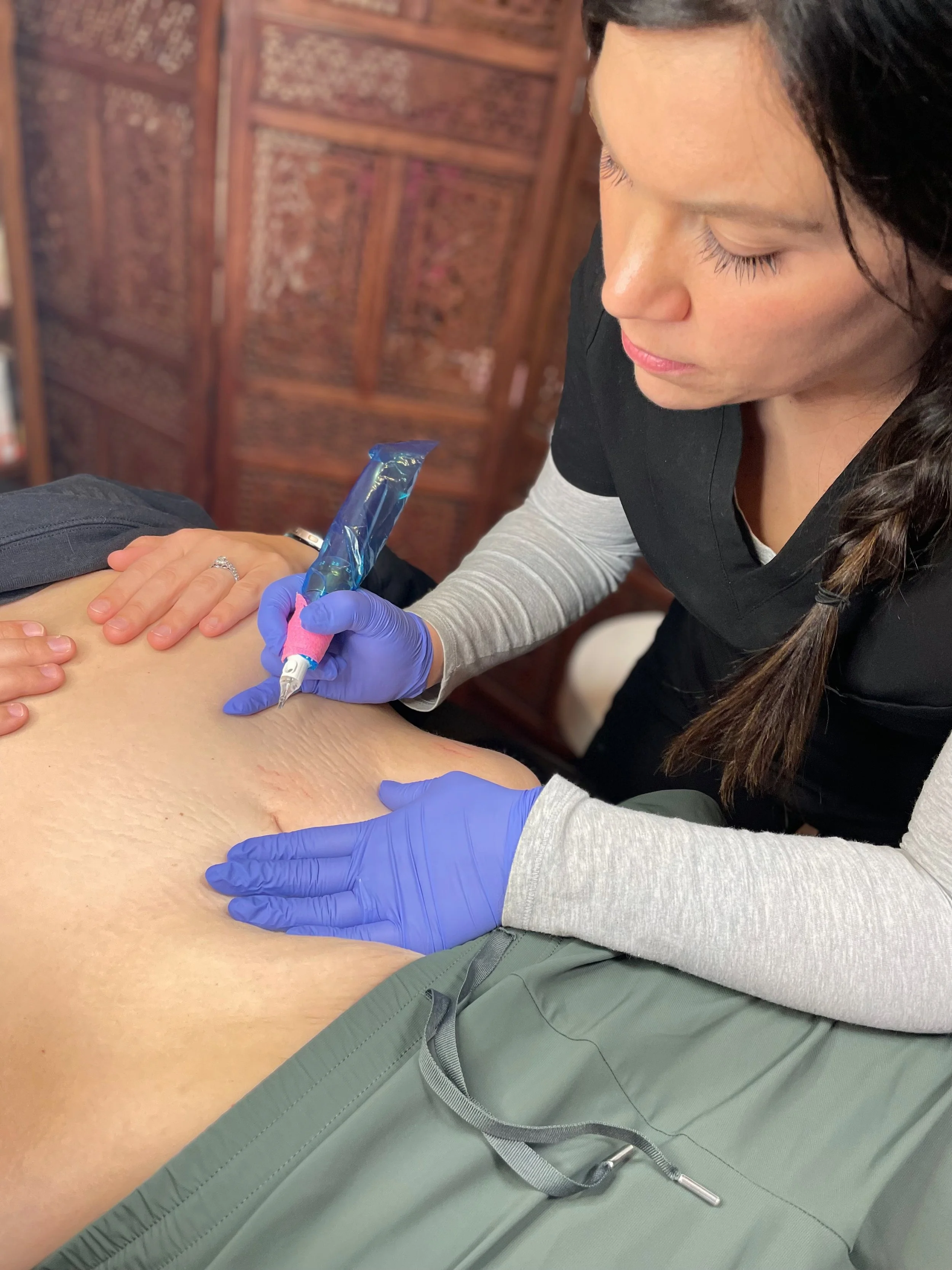 Medical professional tattooist wearing purple gloves administering an ink or cosmetic tattoo to a person's skin.