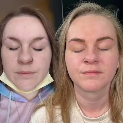 Before and after eyebrow transformation with natural-looking microblading.