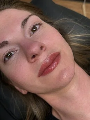 Before and after lip blush tattoo creating symmetrical and youthful lips