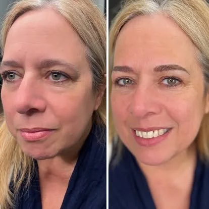 Natural eyebrow enhancement before and after with microblading and shading