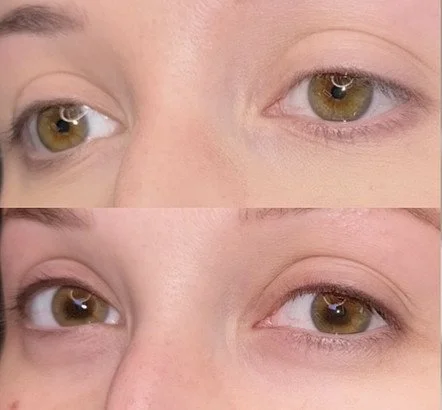 Before and after Eyelash Enhancement tattoo creating more pronounced lash line.