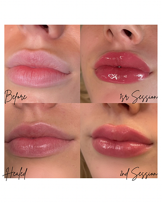 Before and after Lip Blushing showing warm, balanced lip tint.