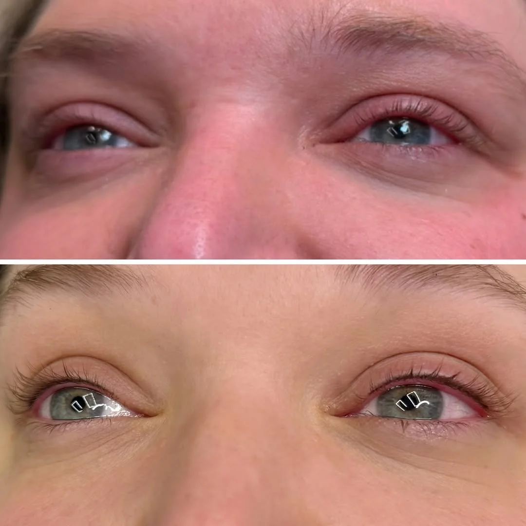 Before and after lash enhancement tattoo giving soft eyeliner effect