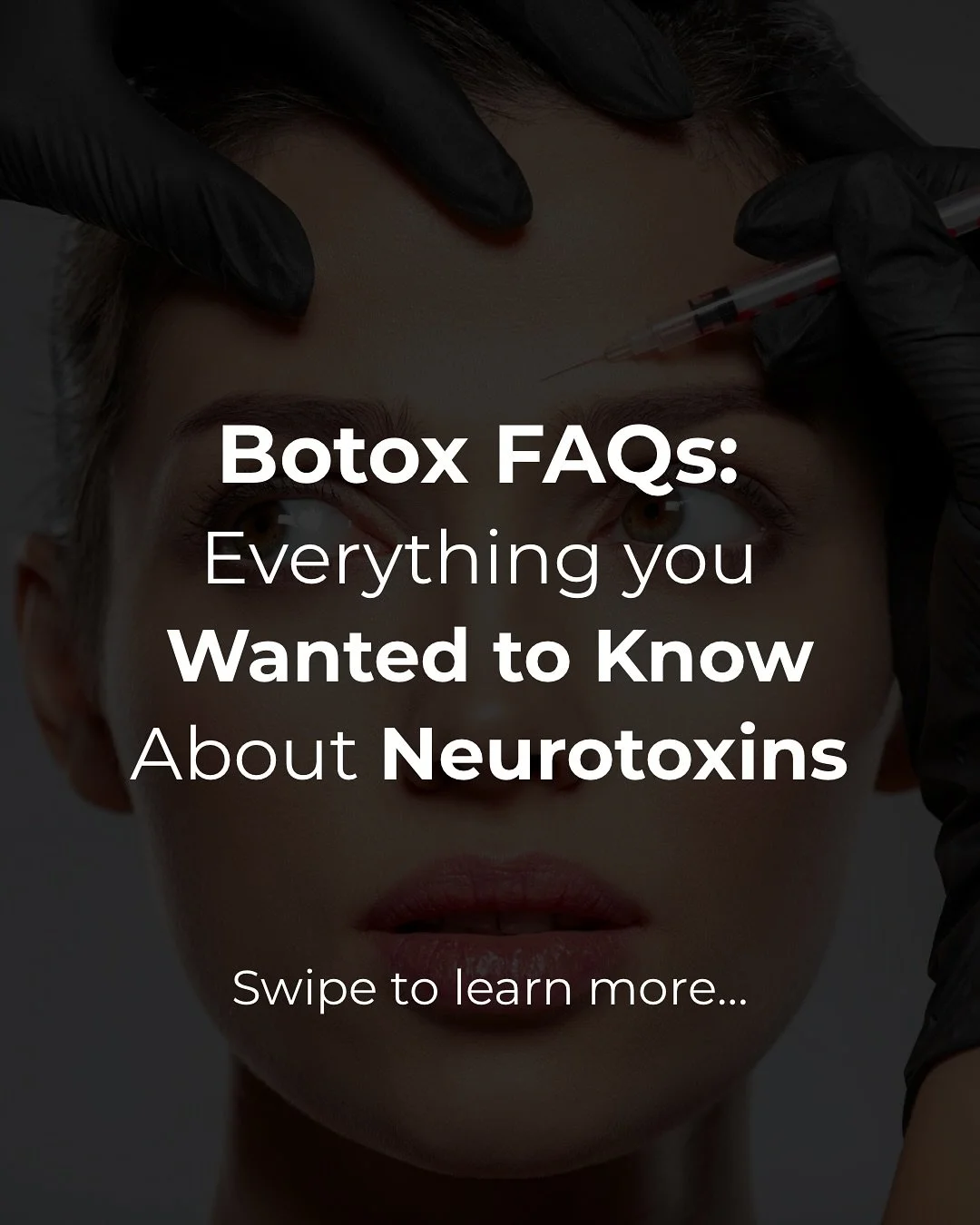 💉✨ Botox FAQ &mdash; Let&rsquo;s Talk About It ✨💉

Not sure if you need Botox or filler? You&rsquo;re not alone &mdash; I get these questions all the time.

This post breaks down the basics (and the not-so-basics), like:
✔️ Will I still be able to 